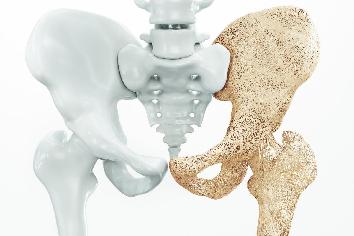 Osteo_Pelvis