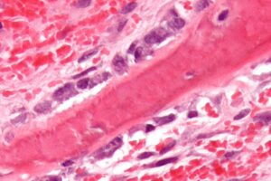Osteoblast