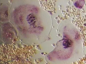 osteoclasts