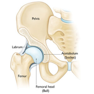hip-img-aaos
